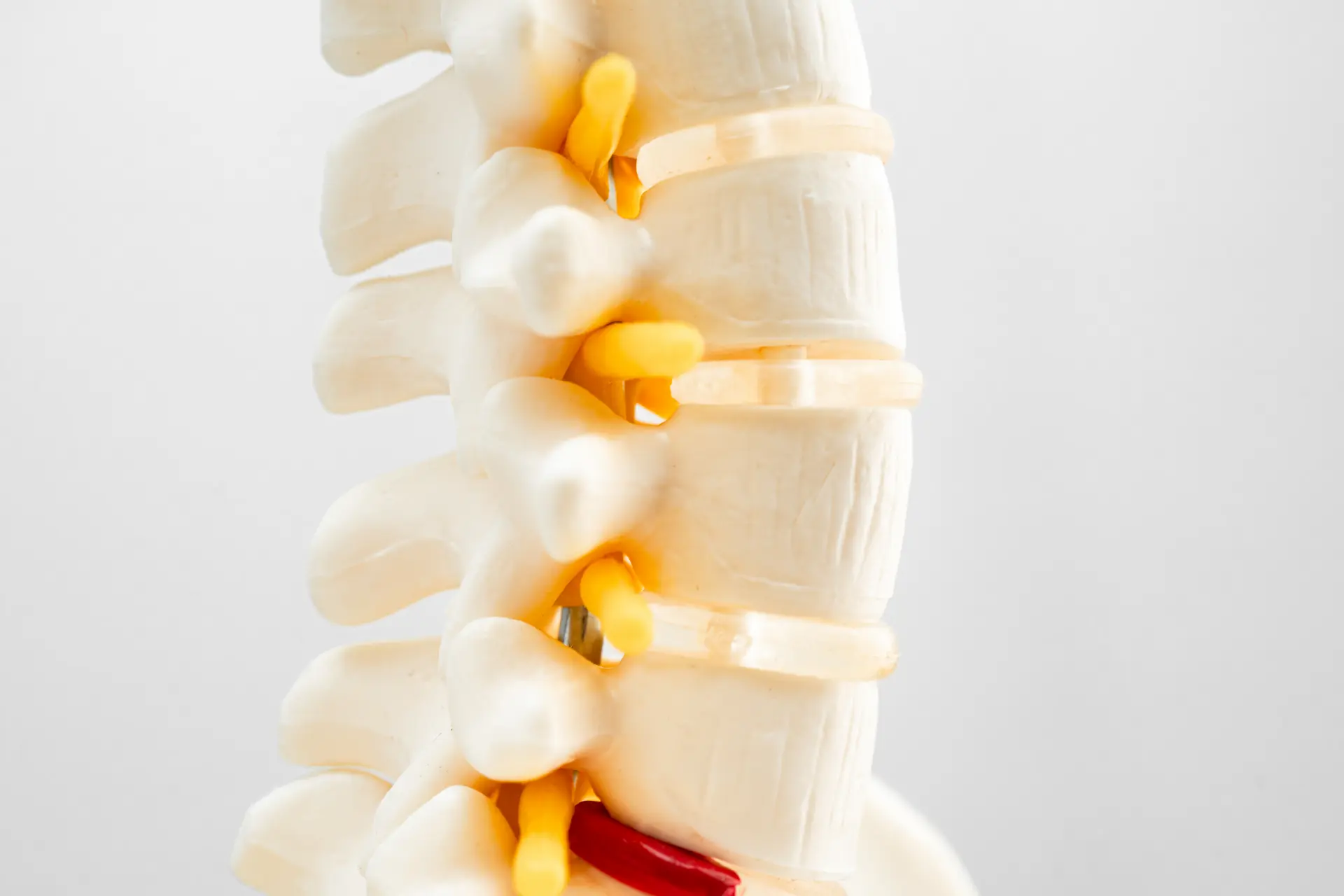 Disc Herniation Chiropractor